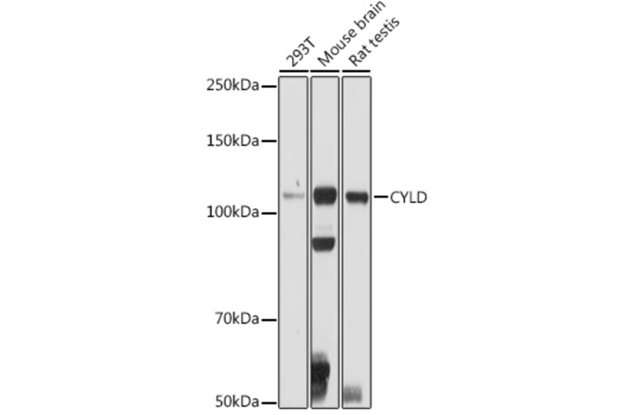 Western Blot - Anti-CYLD Antibody (A14469) - Antibodies.com