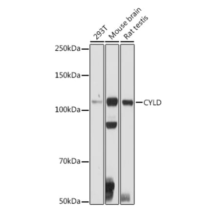 Western Blot - Anti-CYLD Antibody (A14469) - Antibodies.com