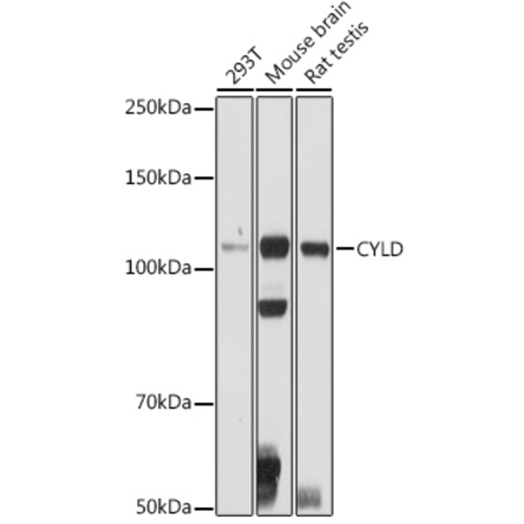 Western Blot - Anti-CYLD Antibody (A14469) - Antibodies.com