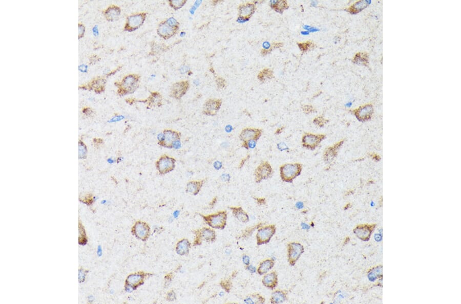 Immunohistochemistry - Anti-CYLD Antibody (A14469) - Antibodies.com