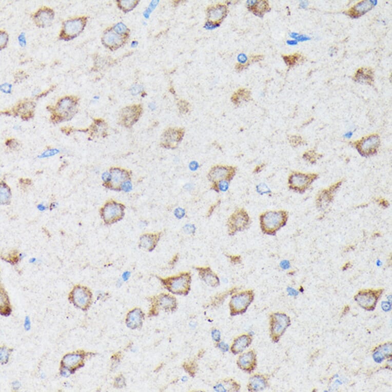 Immunohistochemistry - Anti-CYLD Antibody (A14469) - Antibodies.com