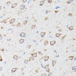 Immunohistochemistry - Anti-CYLD Antibody (A14469) - Antibodies.com