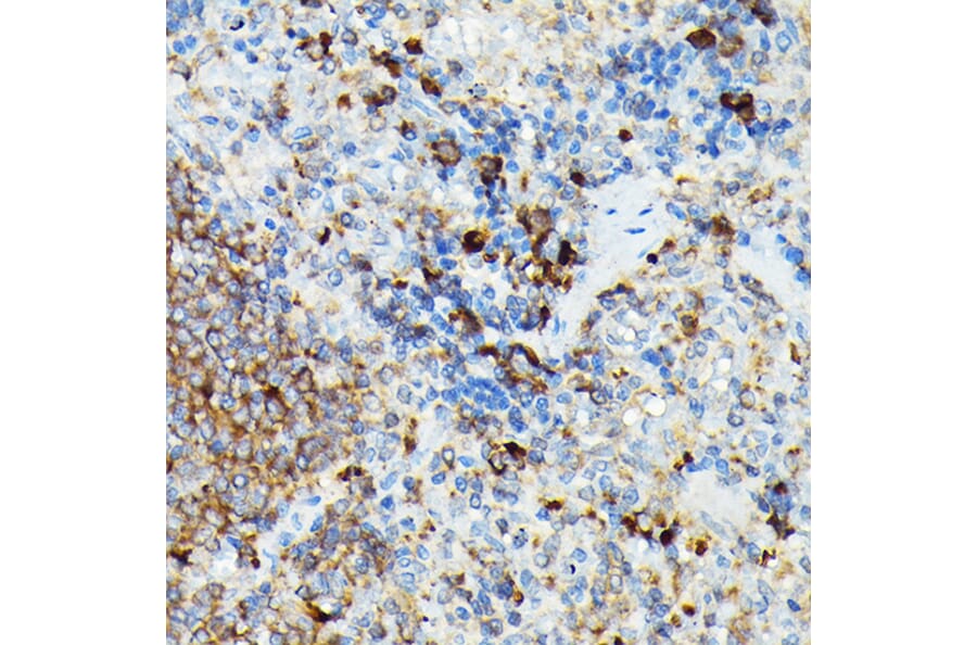 Immunohistochemistry - Anti-CYLD Antibody (A14469) - Antibodies.com
