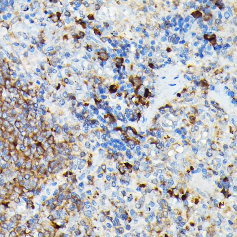 Immunohistochemistry - Anti-CYLD Antibody (A14469) - Antibodies.com