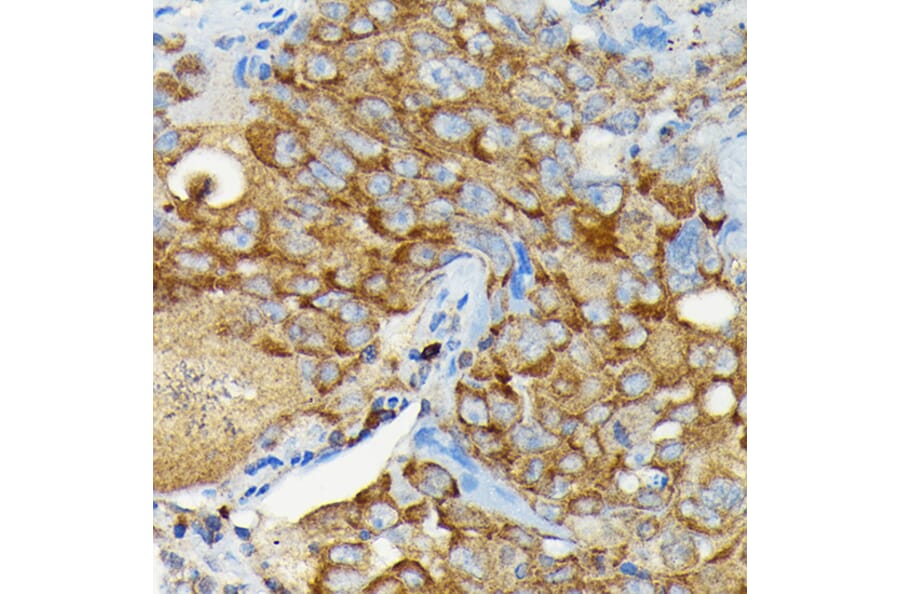 Immunohistochemistry - Anti-CYLD Antibody (A14469) - Antibodies.com