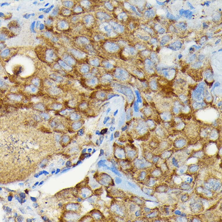 Immunohistochemistry - Anti-CYLD Antibody (A14469) - Antibodies.com