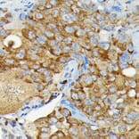 Immunohistochemistry - Anti-CYLD Antibody (A14469) - Antibodies.com