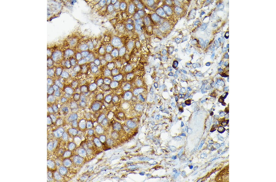 Immunohistochemistry - Anti-CYLD Antibody (A14469) - Antibodies.com