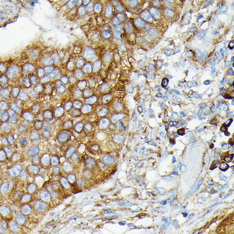 Immunohistochemistry - Anti-CYLD Antibody (A14469) - Antibodies.com