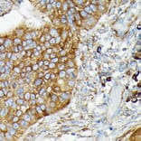 Immunohistochemistry - Anti-CYLD Antibody (A14469) - Antibodies.com