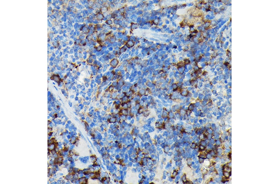 Immunohistochemistry - Anti-CYLD Antibody (A14469) - Antibodies.com