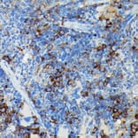 Immunohistochemistry - Anti-CYLD Antibody (A14469) - Antibodies.com