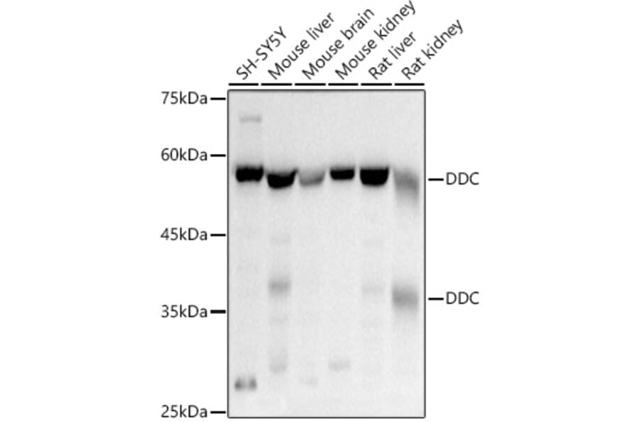 Western Blot - Anti-DOPA Decarboxylase/DDC Antibody (A14470) - Antibodies.com