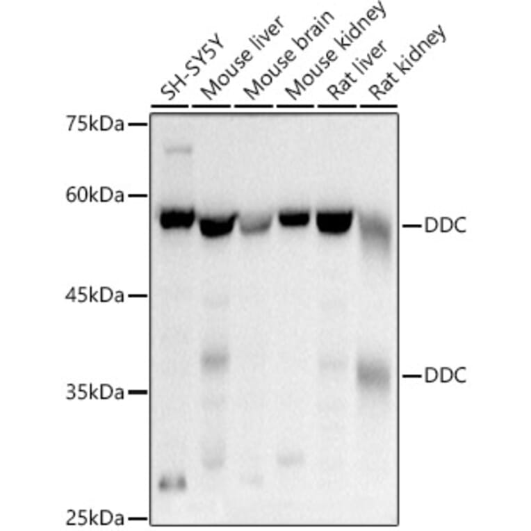 Western Blot - Anti-DOPA Decarboxylase/DDC Antibody (A14470) - Antibodies.com