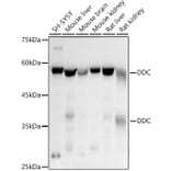 Western Blot - Anti-DOPA Decarboxylase/DDC Antibody (A14470) - Antibodies.com