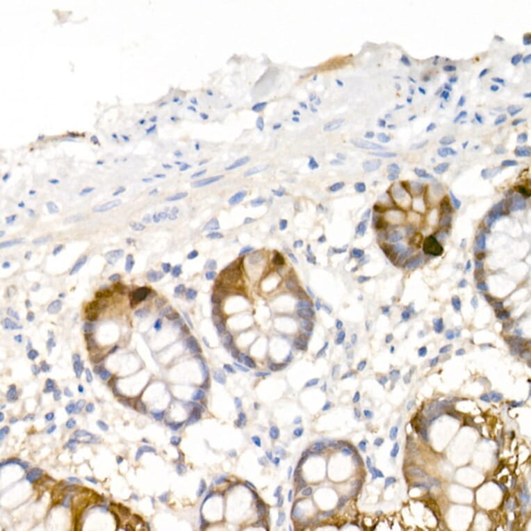 Immunohistochemistry - Anti-DOPA Decarboxylase/DDC Antibody (A14470) - Antibodies.com