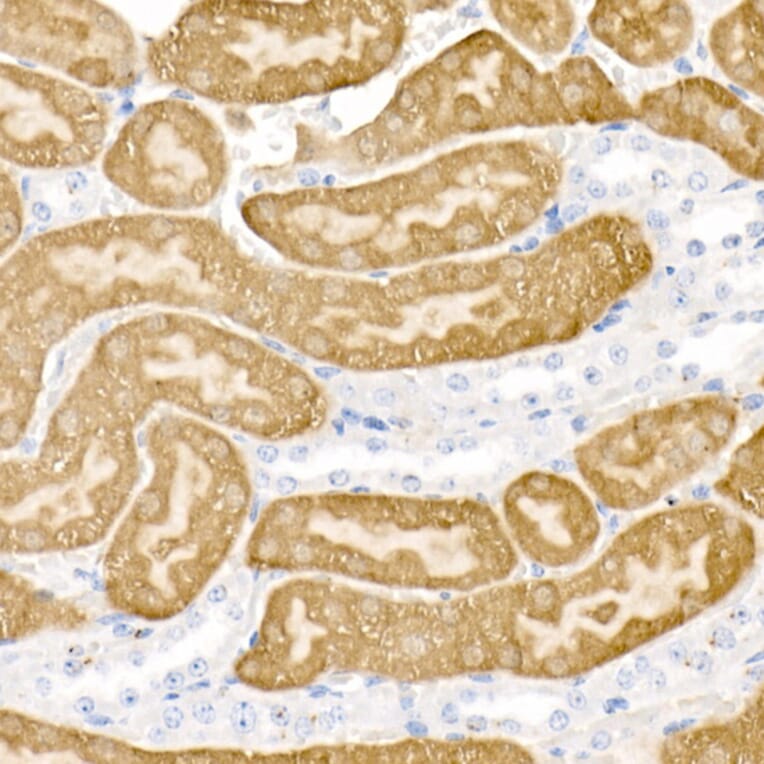 Immunohistochemistry - Anti-DOPA Decarboxylase/DDC Antibody (A14470) - Antibodies.com