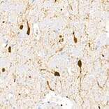 Immunohistochemistry - Anti-DOPA Decarboxylase/DDC Antibody (A14470) - Antibodies.com