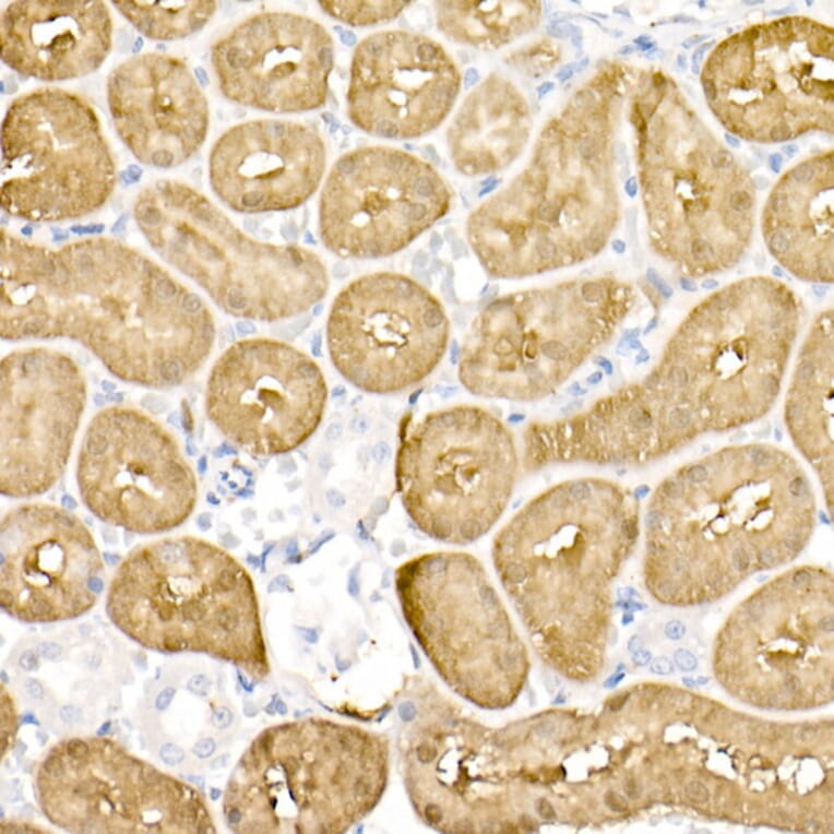 Immunohistochemistry - Anti-DOPA Decarboxylase/DDC Antibody (A14470) - Antibodies.com