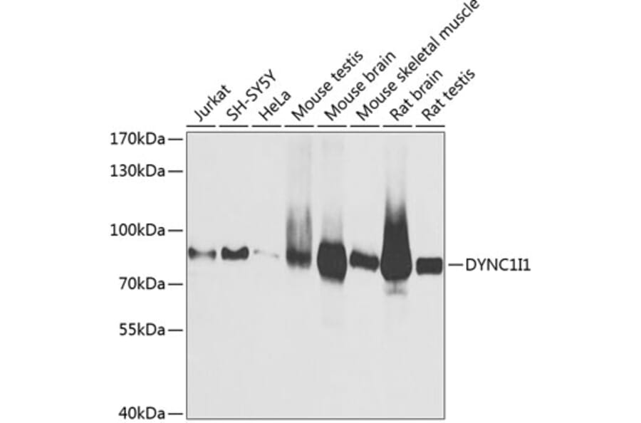 Western Blot - Anti-Cytoplasmic Dynein Intermediate chain Antibody (A14471) - Antibodies.com