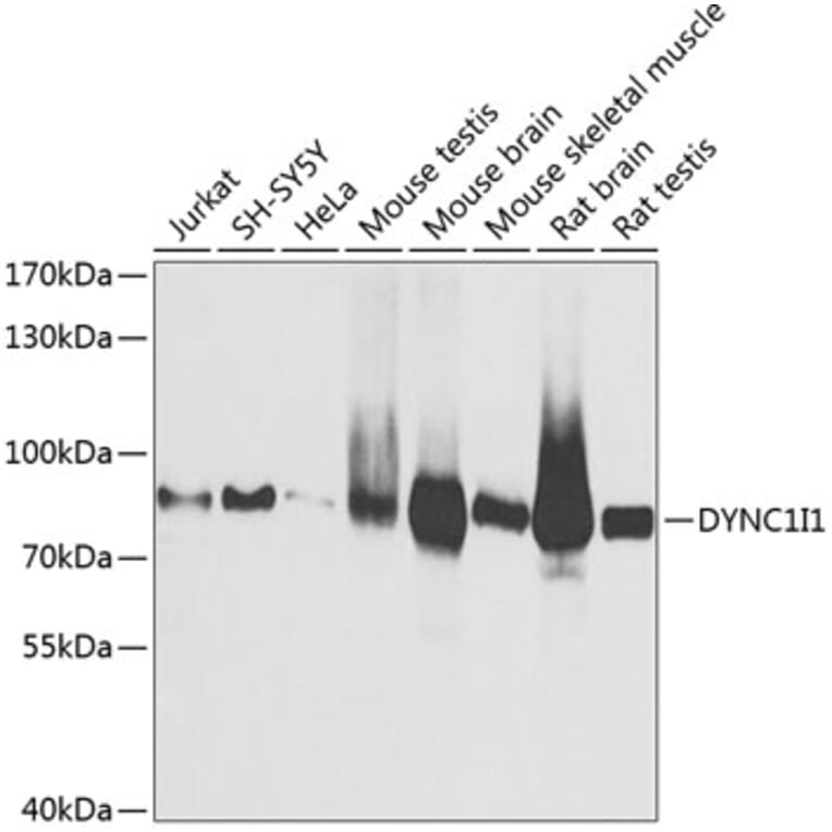 Western Blot - Anti-Cytoplasmic Dynein Intermediate chain Antibody (A14471) - Antibodies.com