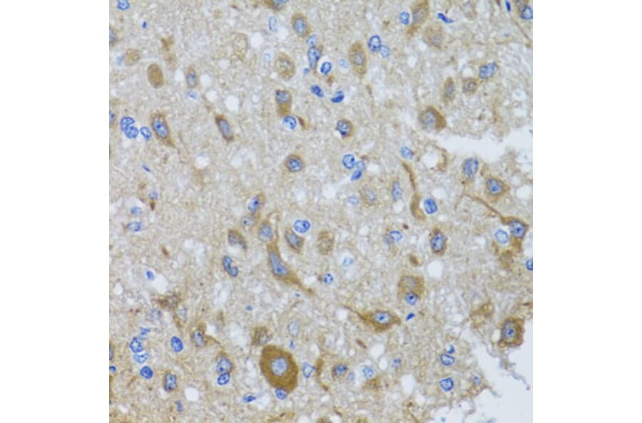 Immunohistochemistry - Anti-Cytoplasmic Dynein Intermediate chain Antibody (A14471) - Antibodies.com