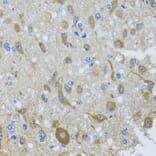 Immunohistochemistry - Anti-Cytoplasmic Dynein Intermediate chain Antibody (A14471) - Antibodies.com