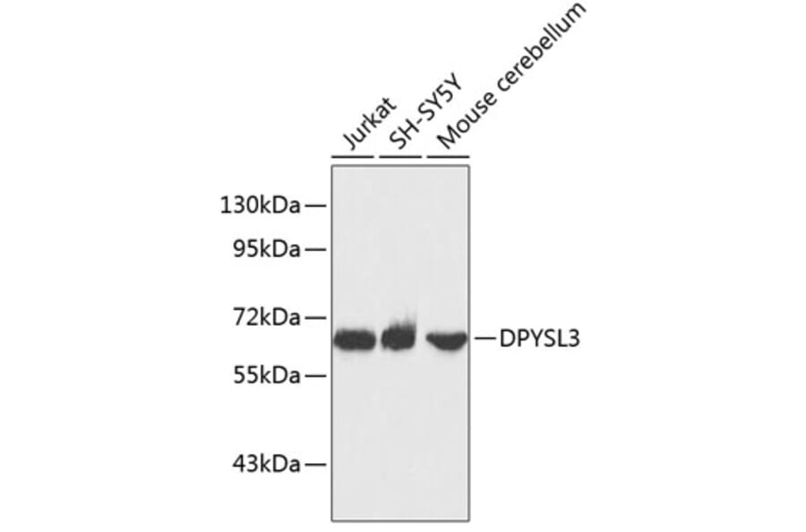 Western Blot - Anti-DPYSL3 Antibody (A3834) - Antibodies.com