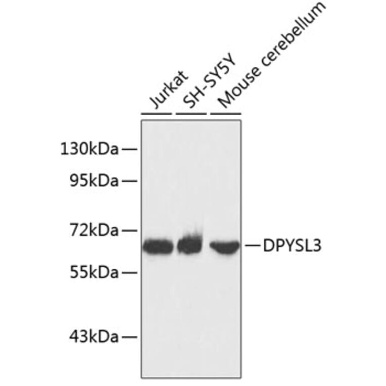 Western Blot - Anti-DPYSL3 Antibody (A3834) - Antibodies.com