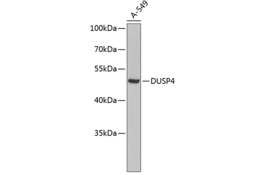 Western Blot - Anti-DUSP4 Antibody (A3838) - Antibodies.com