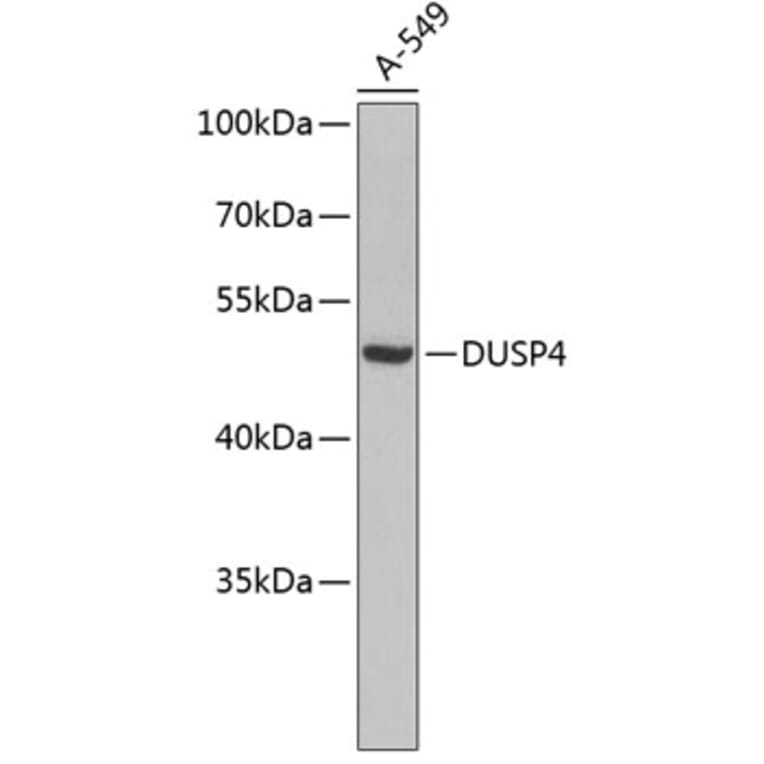 Western Blot - Anti-DUSP4 Antibody (A3838) - Antibodies.com