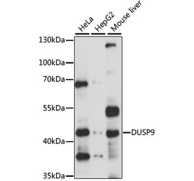 Western Blot - Anti-DUSP9 Antibody (A14474) - Antibodies.com