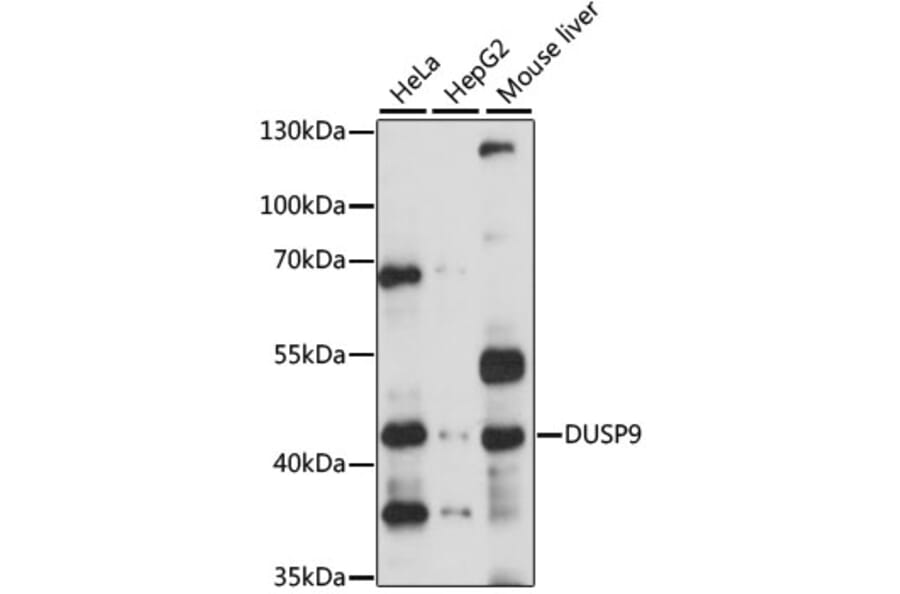 Western Blot - Anti-DUSP9 Antibody (A14474) - Antibodies.com