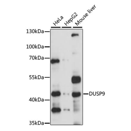 Western Blot - Anti-DUSP9 Antibody (A14474) - Antibodies.com