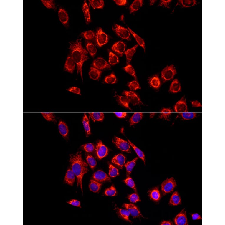 Immunofluorescence - Anti-ECHS1 Antibody (A14476) - Antibodies.com