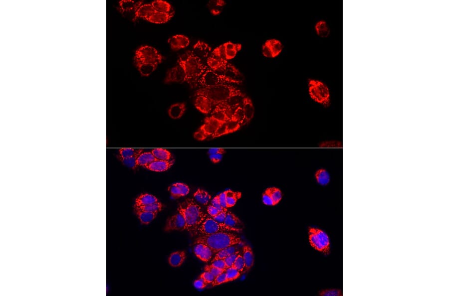 Immunofluorescence - Anti-ECHS1 Antibody (A14476) - Antibodies.com