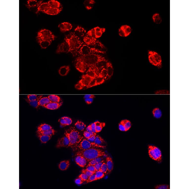 Immunofluorescence - Anti-ECHS1 Antibody (A14476) - Antibodies.com