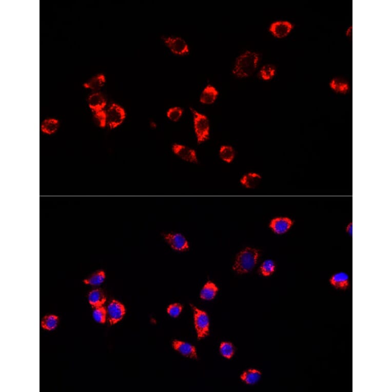 Immunofluorescence - Anti-ECHS1 Antibody (A14476) - Antibodies.com