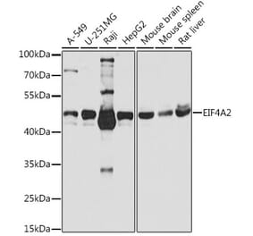 Western Blot - Anti-eIF4A2 Antibody (A14477) - Antibodies.com