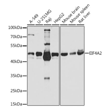 Western Blot - Anti-eIF4A2 Antibody (A14477) - Antibodies.com