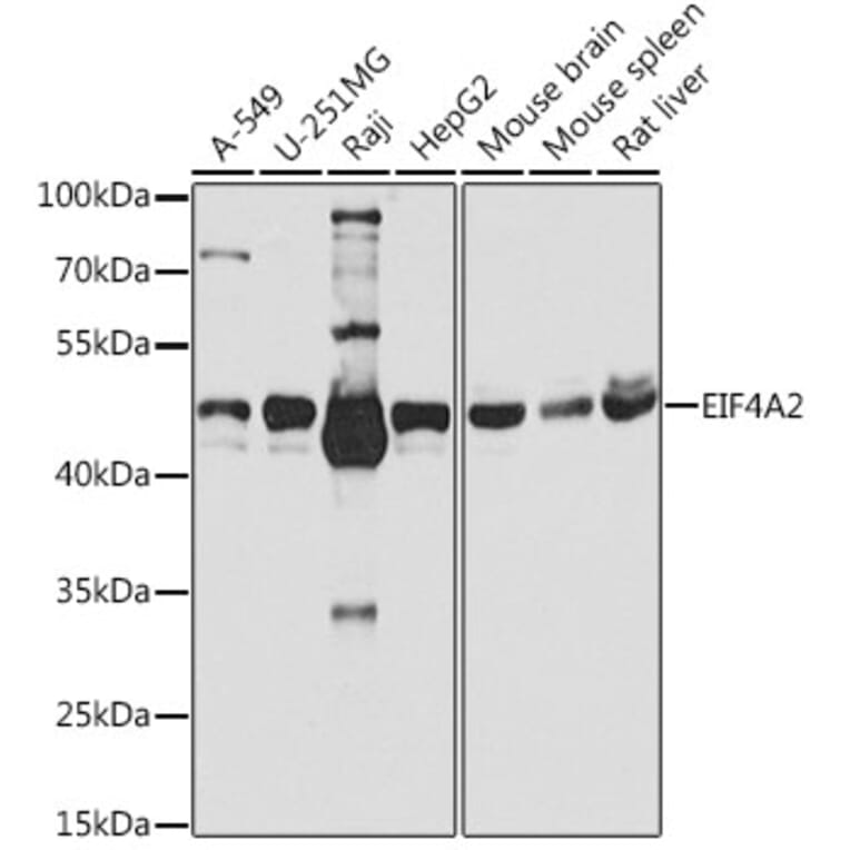 Western Blot - Anti-eIF4A2 Antibody (A14477) - Antibodies.com