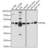 Western Blot - Anti-eIF4A2 Antibody (A14477) - Antibodies.com