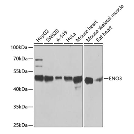 Western Blot - Anti-ENO3 Antibody (A14478) - Antibodies.com