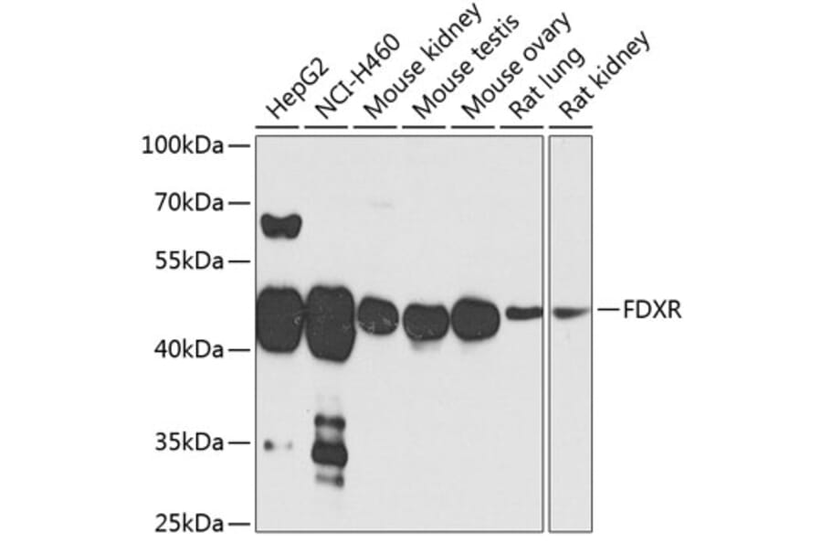 Western Blot - Anti-Ferredoxin Reductase Antibody (A14480) - Antibodies.com