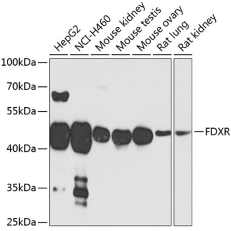 Western Blot - Anti-Ferredoxin Reductase Antibody (A14480) - Antibodies.com