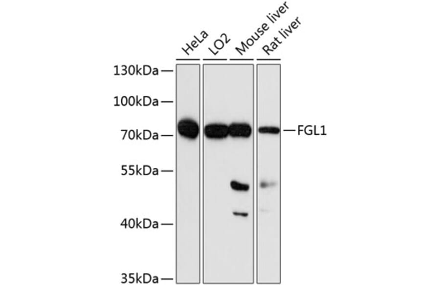Western Blot - Anti-FGL1 Antibody (A3862) - Antibodies.com