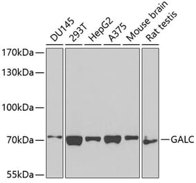 Western Blot - Anti-GALC Antibody (A14482) - Antibodies.com