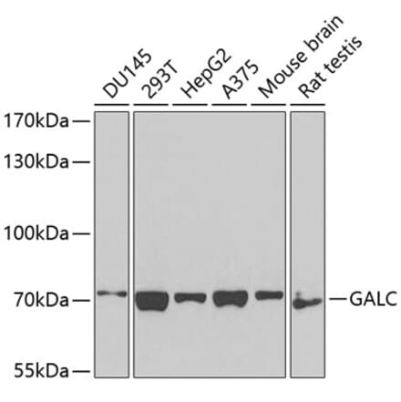 Western Blot - Anti-GALC Antibody (A14482) - Antibodies.com