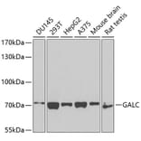 Western Blot - Anti-GALC Antibody (A14482) - Antibodies.com