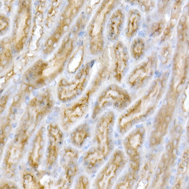 Immunohistochemistry - Anti-GALC Antibody (A14482) - Antibodies.com